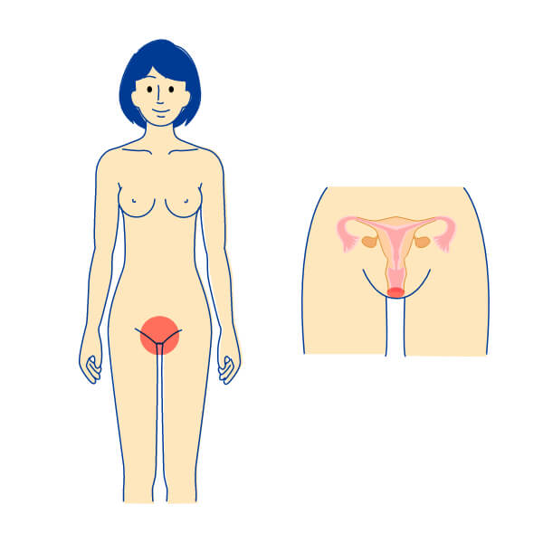 尖圭コンジローマ